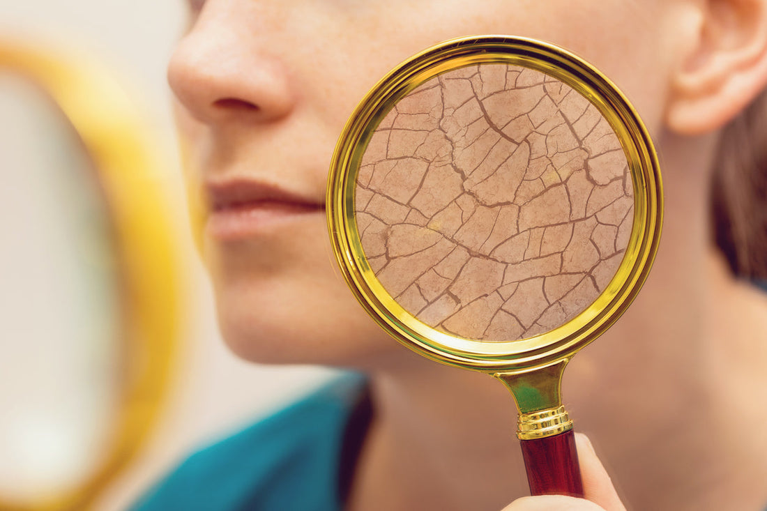 How To Treat Dry Vs Dehydrated Skin: What's The Difference?