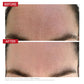 Dr Levy 3Deep Cleanser 150ml - before and after results