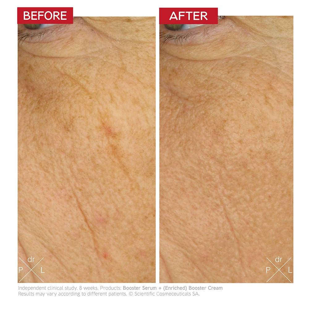 Dr Levy Intense Stem Cell Enriched Booster Cream 50ml — image 3