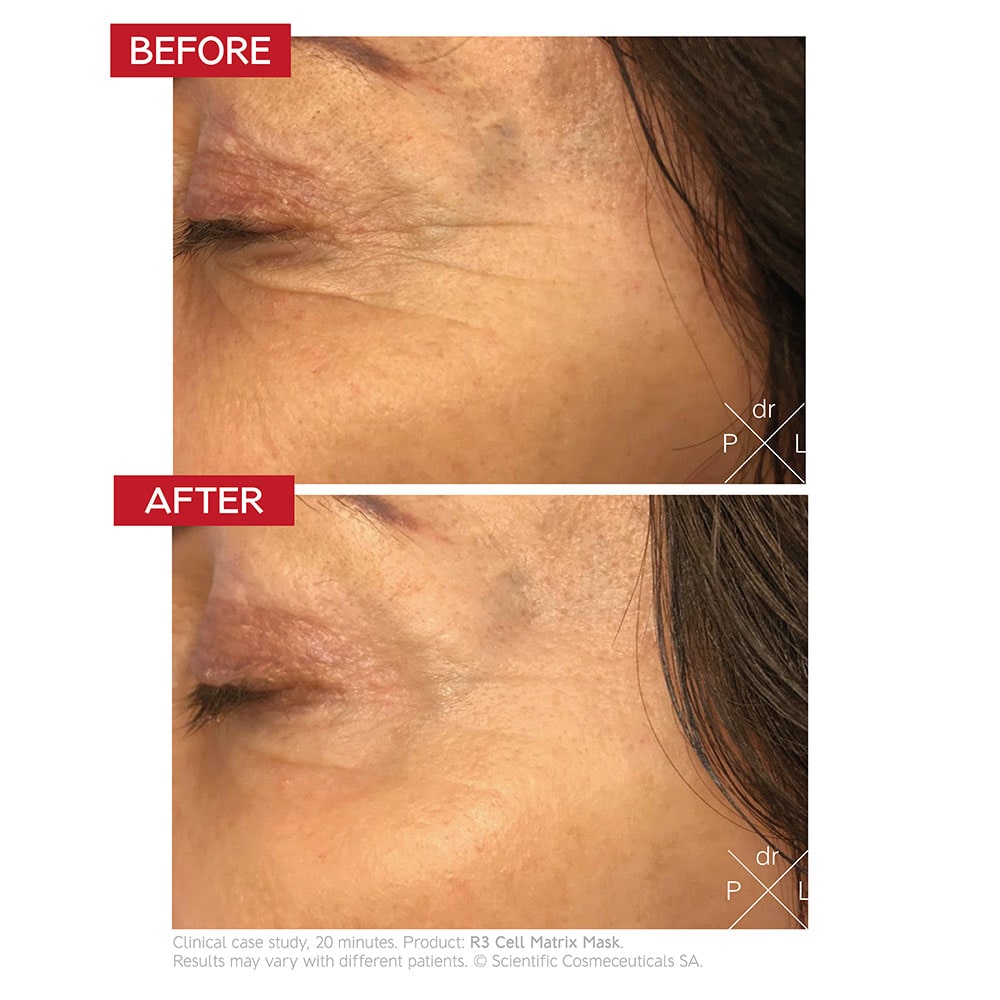 Dr Levy R3 Cell Matrix Mask 50ml — image 3
