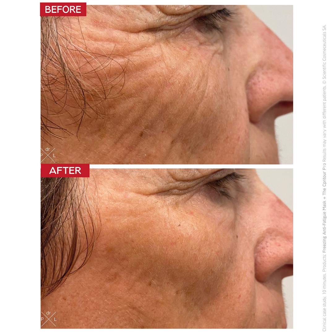 Dr Levy The Contour Pro — image 5