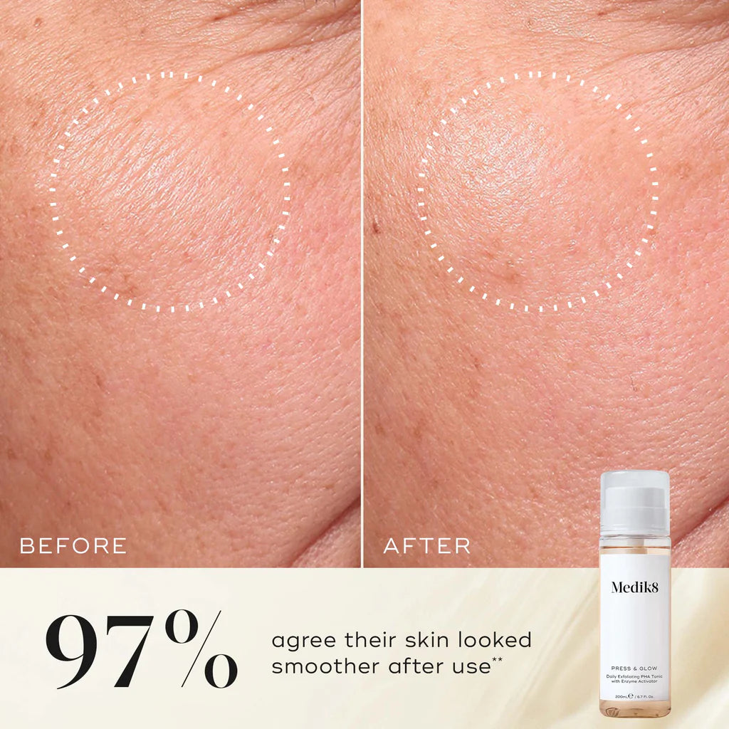 Before and after close-up of skin texture after using Medik8 Press & Glow, with 97% agreeing their skin looked smoother after use, shown beside the Press & Glow bottle.